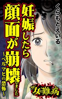 ザ・女の難病　妊娠したら顔面が崩壊しました～ベルマヒの恐怖～