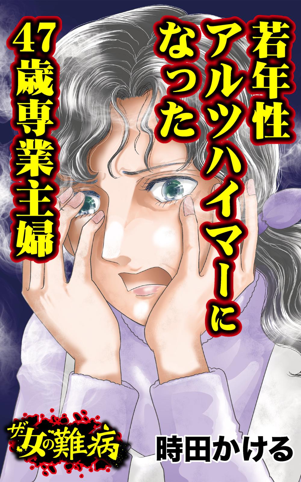 ザ・女の難病　若年性アルツハイマーになった47歳専業主婦